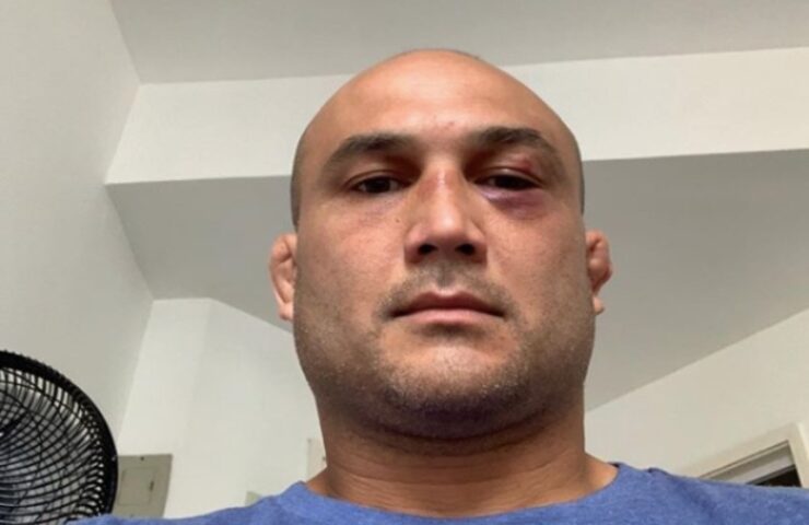 B.J. Penn Shared: “CTE Is Fake, A Lie Used To Cover Up Murders”